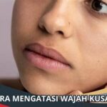 Tips Mengatasi Kulit Wajah Kusam